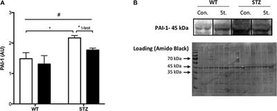 Statin Therapy Negatively Impacts Skeletal Muscle Regeneration and Cutaneous Wound Repair in Type 1 Diabetic Mice